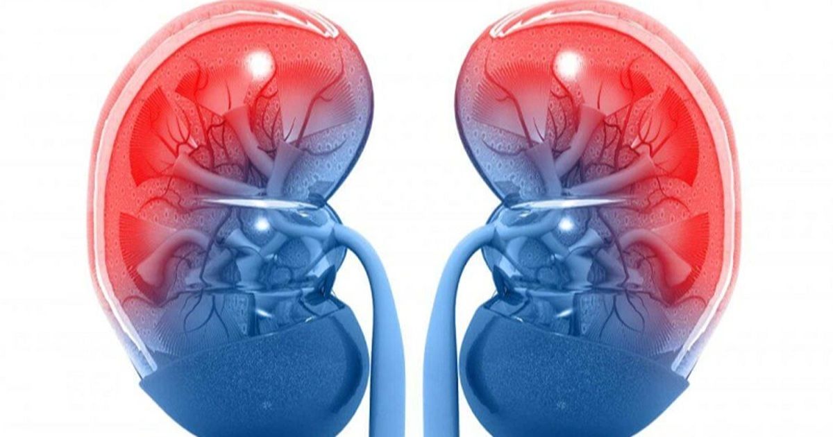 Căn bệnh hiếm khiến 46% người bệnh có tiến triển suy thận