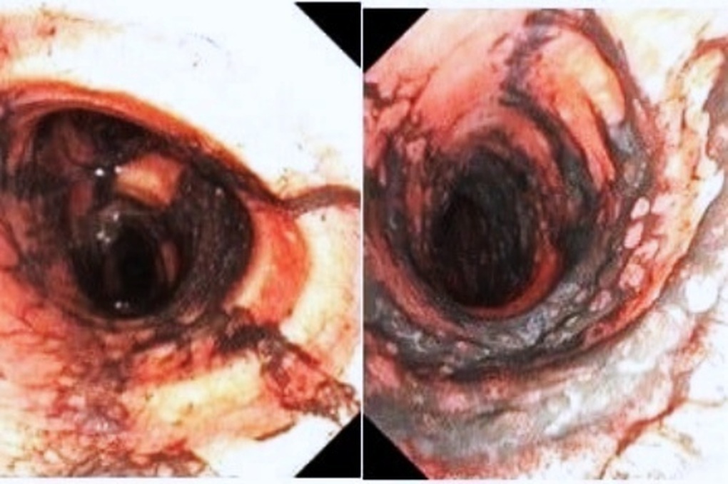 Vợ chồng ngạt khói, tổn thương đa cơ quan nguy kịch trong vụ cháy ở TPHCM - 1