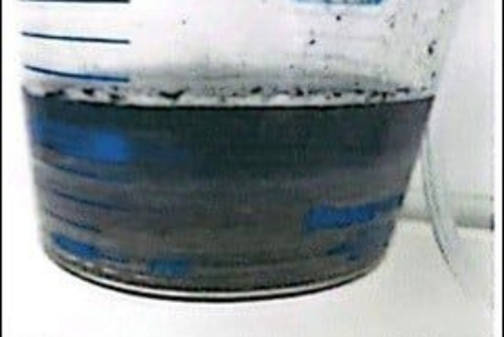 Vợ chồng ngạt khói, tổn thương đa cơ quan nguy kịch trong vụ cháy ở TPHCM - 2