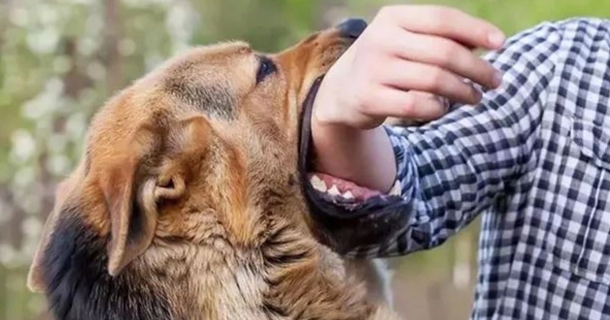 Nhiều người ở TPHCM bị chó cắn