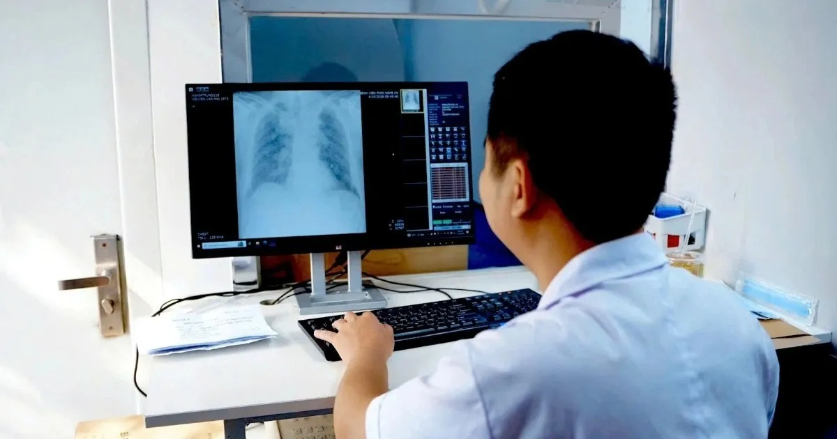 Một đợt khám sức khỏe cộng đồng, phát hiện 171 ca nghi mắc lao