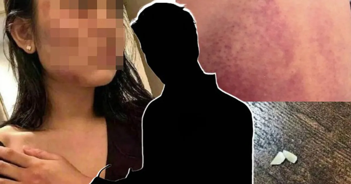 Sao nam ra tay hành hung phụ nữ bị tạm giam 30 ngày sau khi trình diện cảnh sát, các ông bầu hủy show hàng loạt