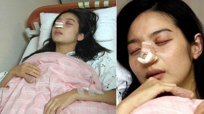 Bi kịch nữ diễn viên ly hôn sau 12 ngày cưới vì bị chồng đánh sảy thai, nhìn thương tích mà nhói lòng- Ảnh 2.