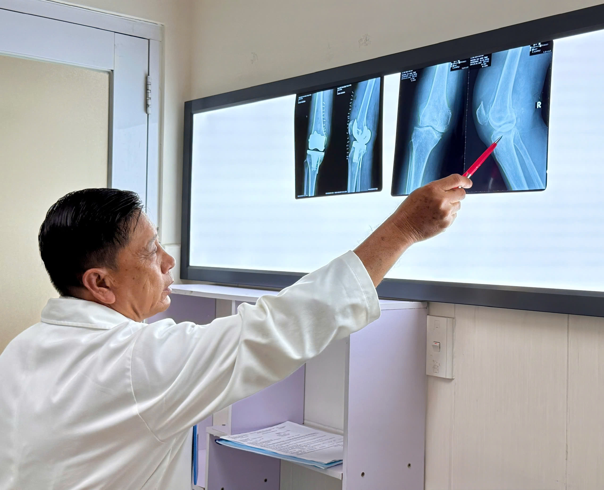 thay khớp - Ảnh 2.