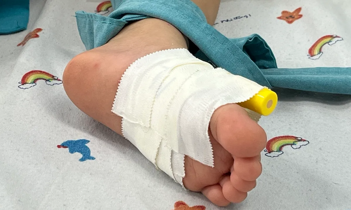 5 lưu ý về bệnh tay chân miệng do virus EV71 - Báo VnExpress 