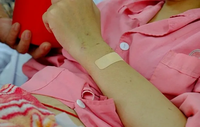 Cơ thể bệnh nhân nổi nhiều ban đỏ do bệnh lupus. Ảnh:Lê Phương.